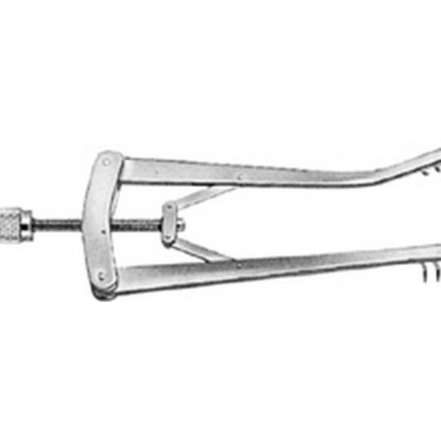 ALM Retractor ALM Retractor
