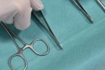 Metzenbaum Scissors